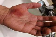 WEEK 6: Left hand injury (opposite arm)